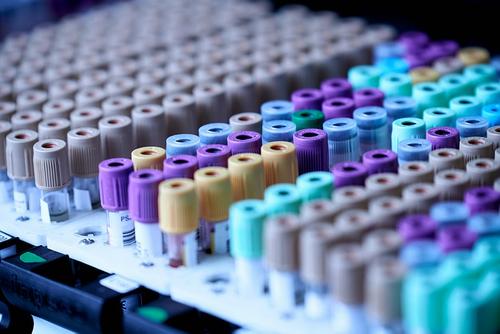 В России возросла выживаемость среди онкобольных В России возросла выживаемость среди онкобольных